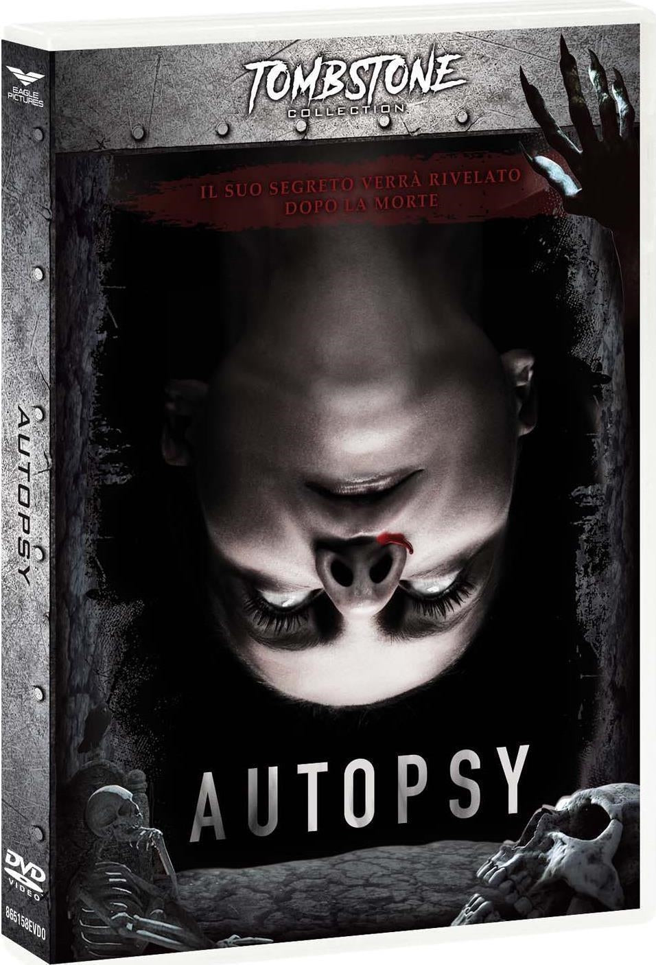 Autopsy (Tombstone)