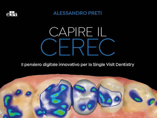 Cover of Capire il CEREC. Il pensiero digitale innovativo per la Single Visit Dentistry