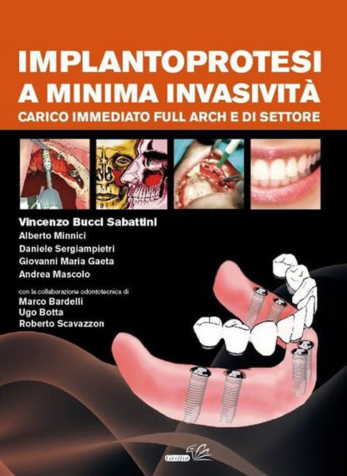 Cover of Implantoprotesi a minima invasività. Carico immediato full arch e di settore