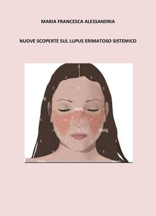 Nuove scoperte sul lupus erimatoso sistemico