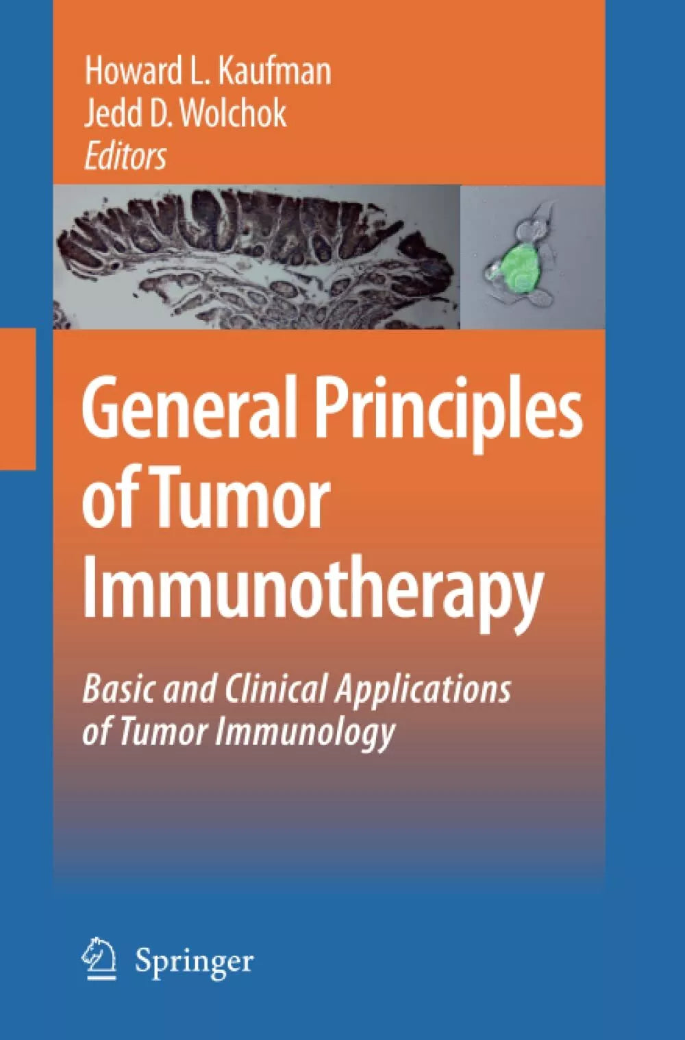 General Principles of Tumor Immunotherapy
