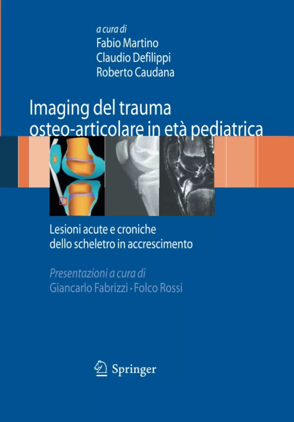 Imaging del trauma osteo
