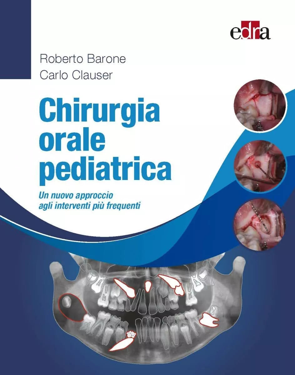 Chirurgia orale pediatrica