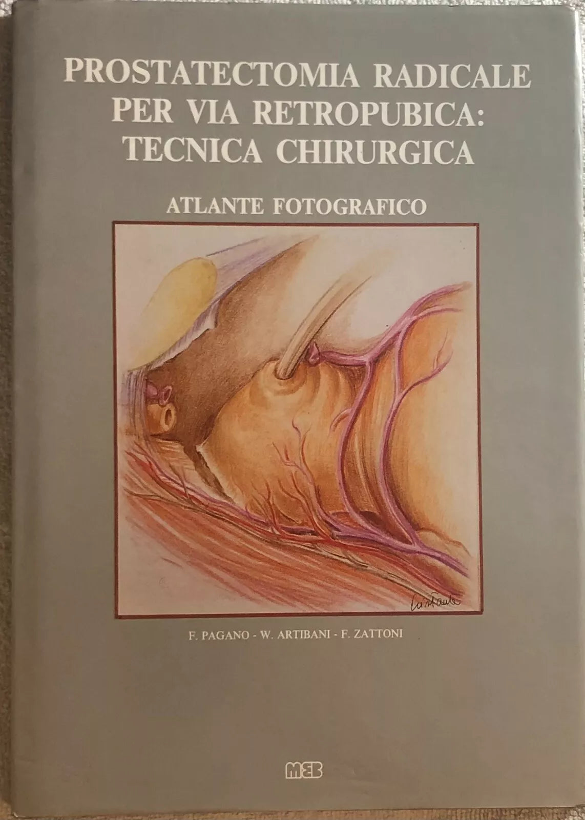 Prostatectomia radicale per via retropubica: tecnica chirurgica di Aa.vv., 1993