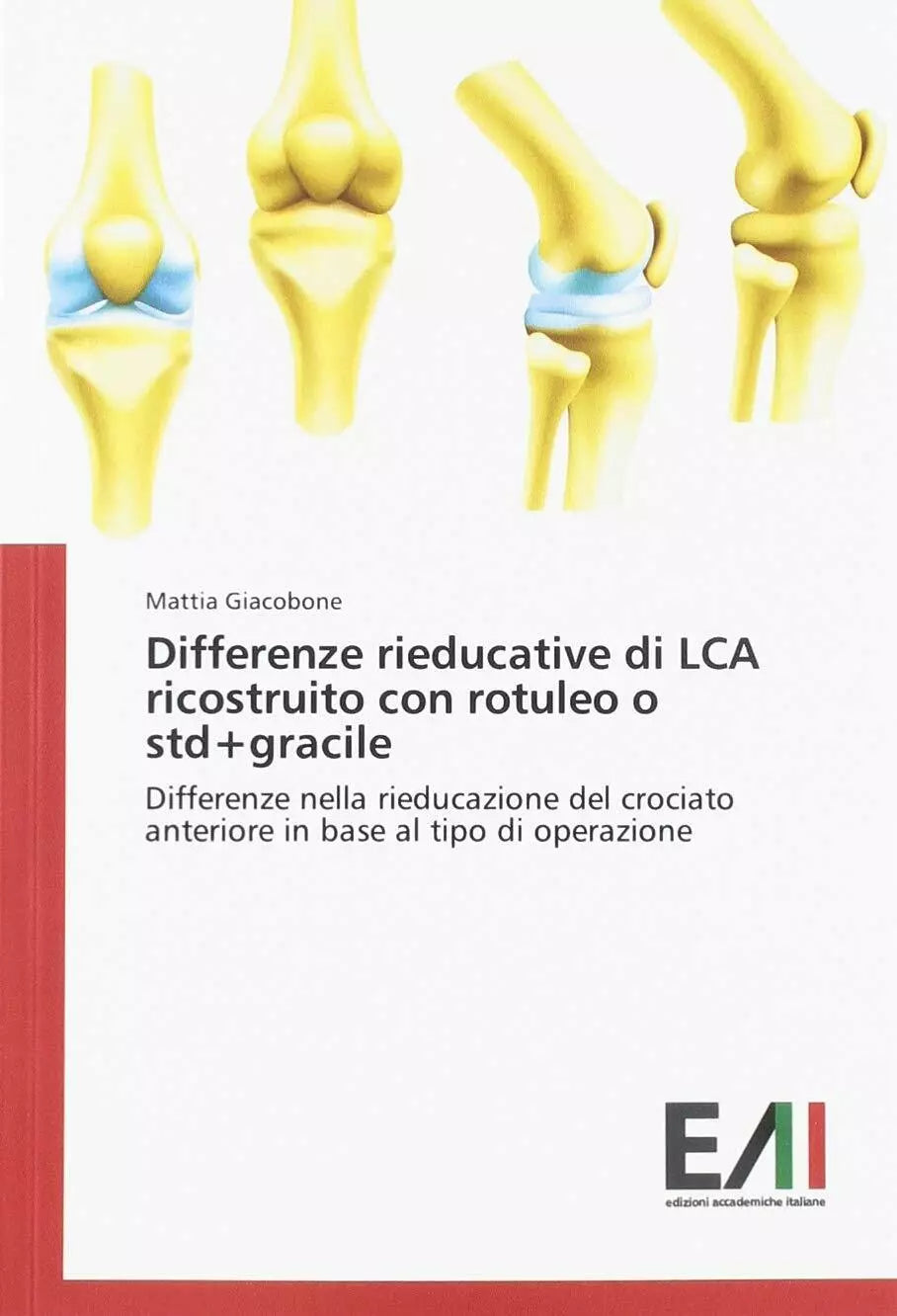 Differenze rieducative di LCA ricostruito con rotuleo o std gracile