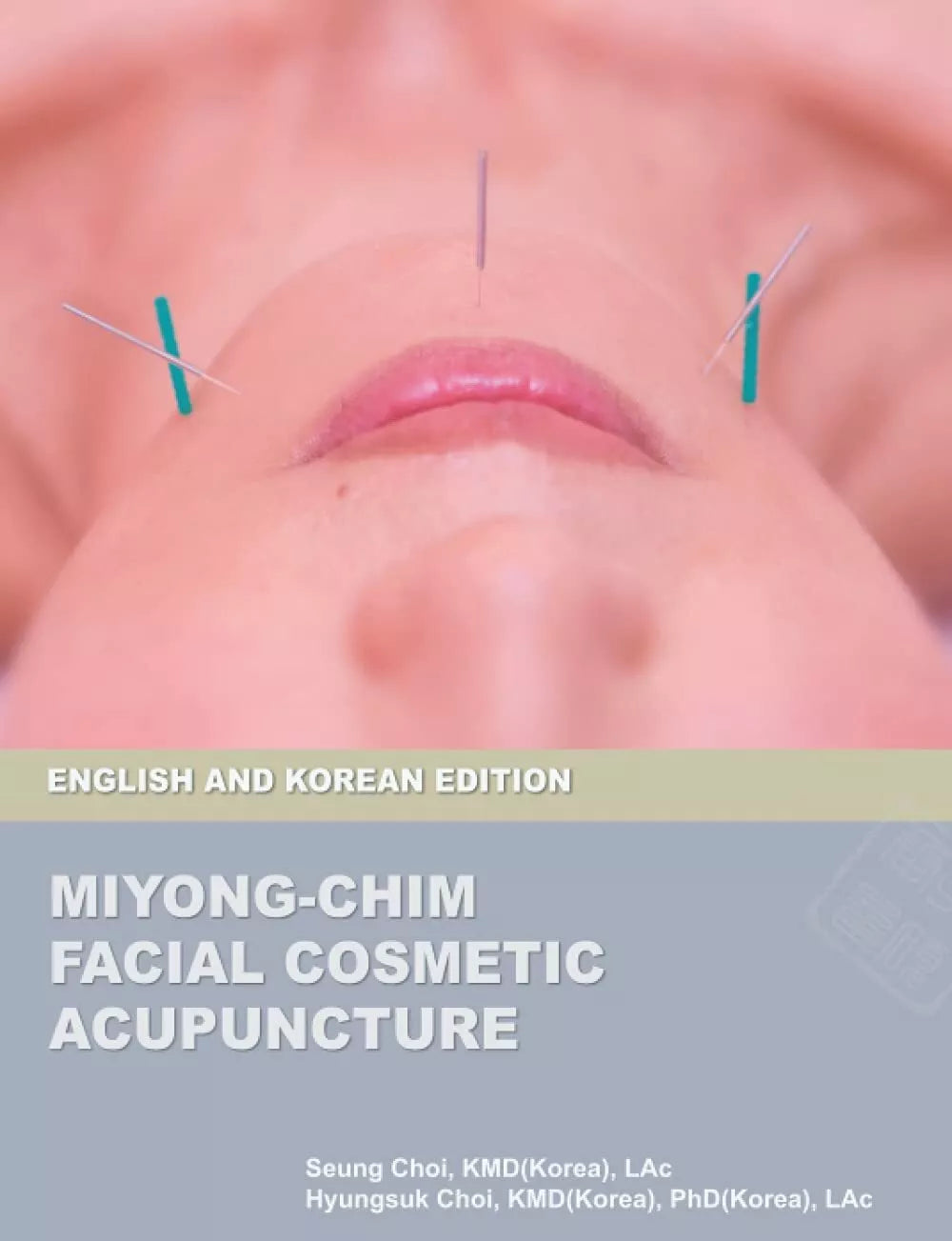 Miyong