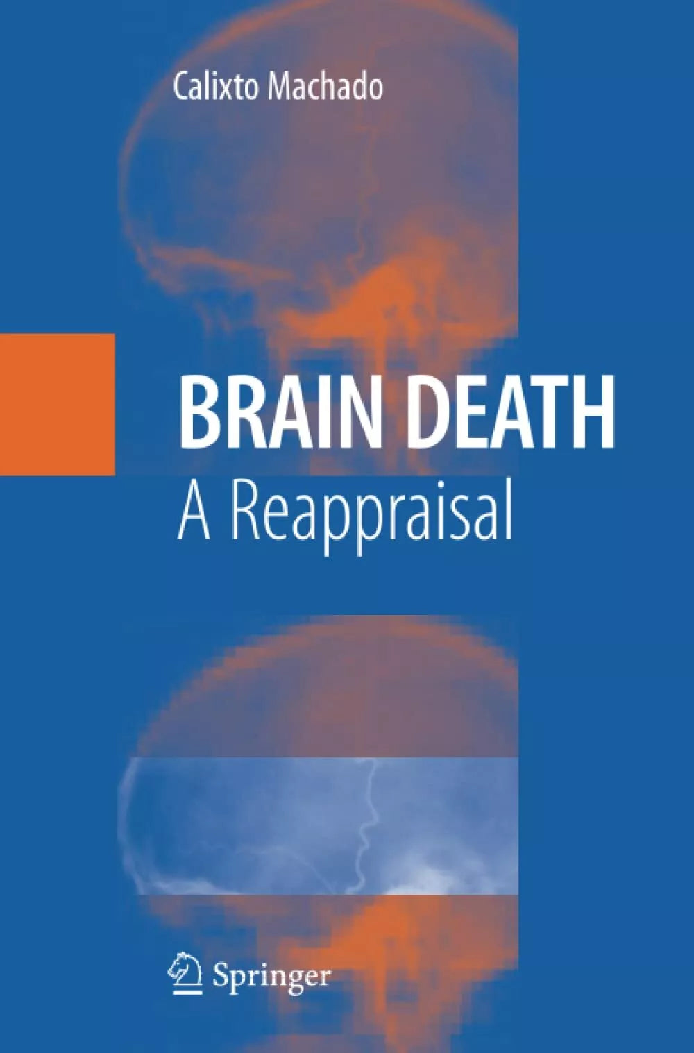 Brain Death