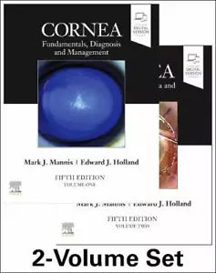 Cornea