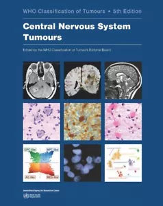 Central Nervous System Tumours