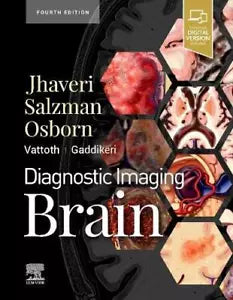 Brain