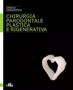Chirurgia parodontale plastica e rigenerativa