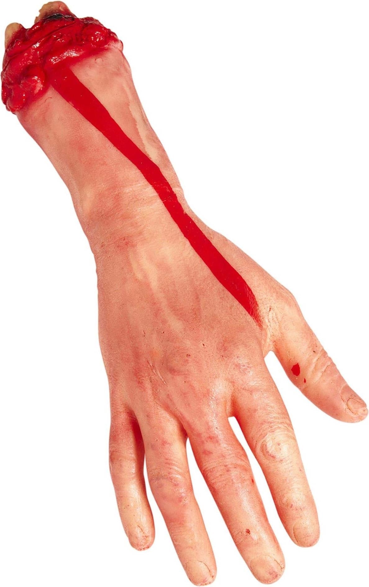 Widmann: Mano Mozzata In Misura Umana