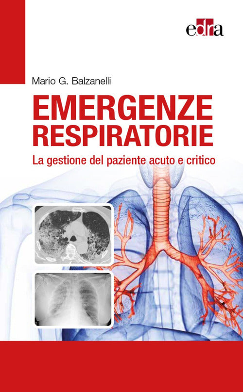 Cover of Emergenze respiratorie. La gestione del paziente acuto e critico