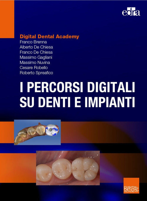 Cover of percorsi digitali su denti e impianti