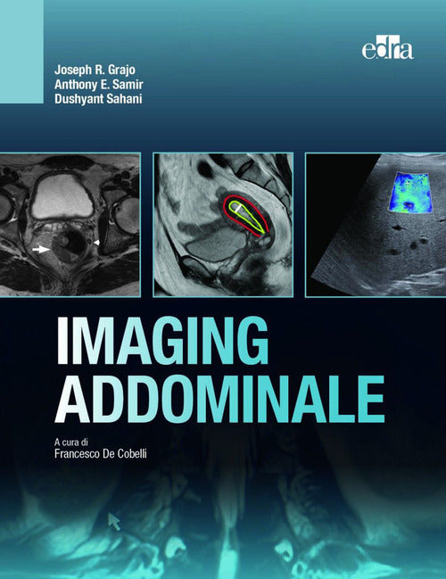 Cover of Imaging addominale