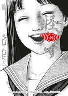 Suture