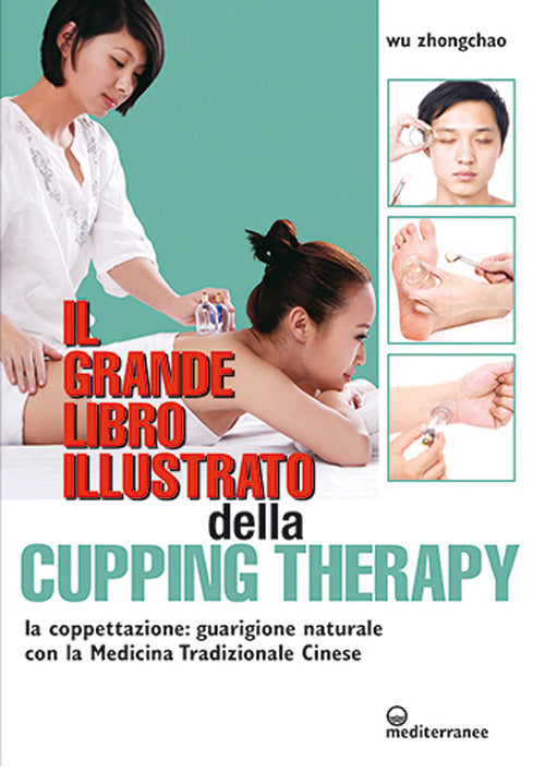 Cover of grande libro illustrato della cupping therapy. La coppettazione: guarigione naturale con la Medicina Tradizionale Cinese