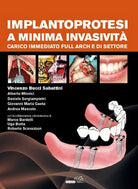 Cover of Implantoprotesi a minima invasività. Carico immediato full arch e di settore
