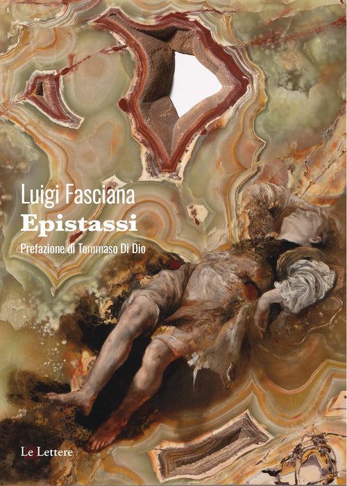 Epistassi