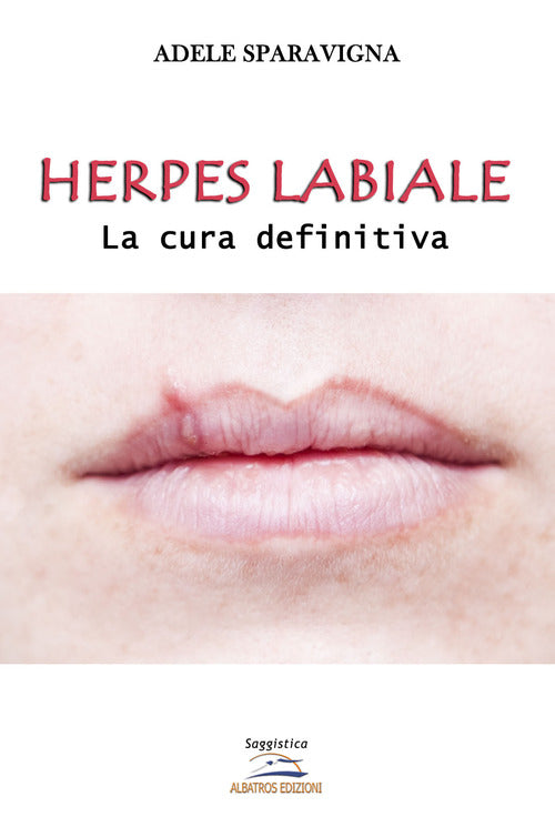 Cover of Herpes labiale. La cura definitiva