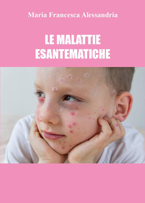 Cover of malattie esantematiche