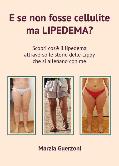 Cover of E se non fosse cellulite ma lipedema?