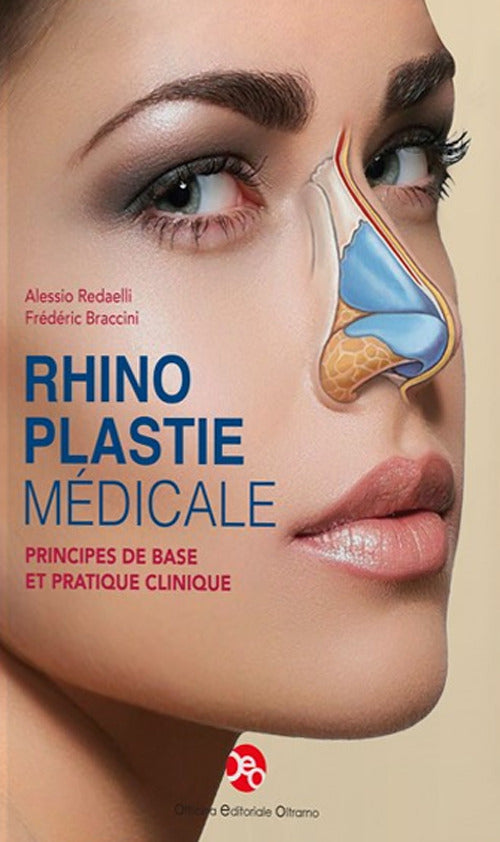 Rhinoplastie mdicale. Principes de base et pratique clinique