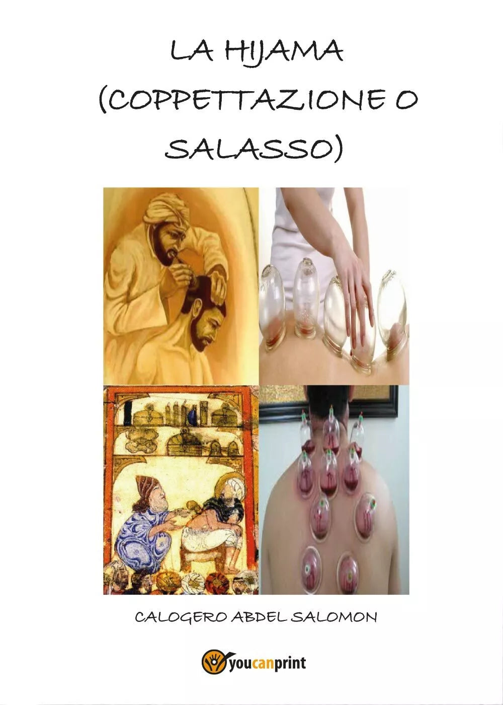 La hijama coppettazione o salasso di Calogero Abdel Salomon, 2017, Youcanpri