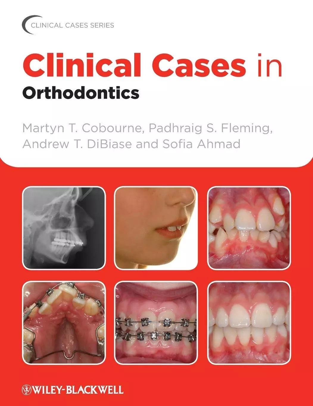 Clinical Cases in Orthodontics