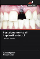 Posizionamento di impianti estetici