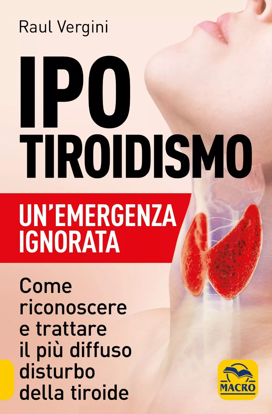 Ipotiroidismo Un emergenza ignorata Come riconoscere e trattare il p diffuso