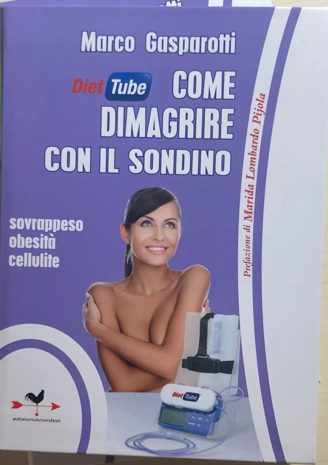 Diet tube come dimagrire con il sondino. Sovrappeso obesita cellulite