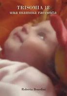 Trisomia 18 Una mamma racconta di Roberta Benedini