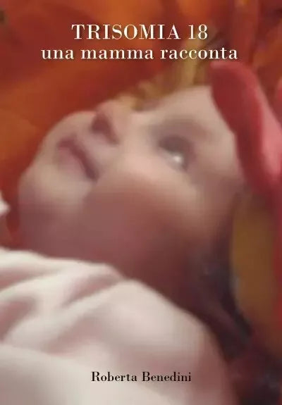 Trisomia 18 Una mamma racconta di Roberta Benedini