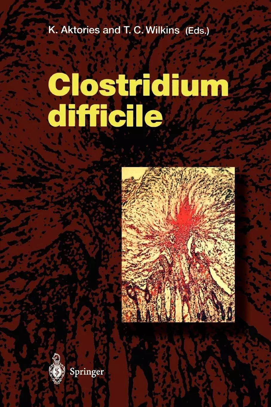 Clostridium Difficile