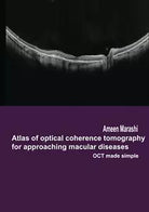 Atlas of Optical Coherence Tomography for Approaching Macular Diseases OCT Made