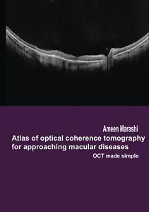 Atlas of Optical Coherence Tomography for Approaching Macular Diseases OCT Made