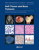 Soft Tissue and Bone Tumours