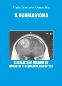 Il Glioblastoma di Maria Francesca Alessandria