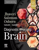 Brain