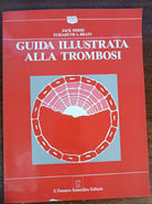 Guida illustrata alla trombosi